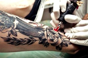 eliminazione tatuaggi roma