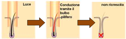 epilazione totale roma