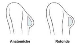 Mastoplastica additiva Protesi 