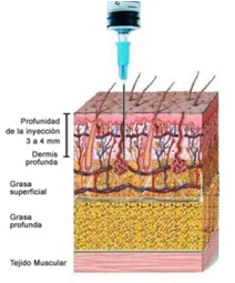 mesoterapia donna roma